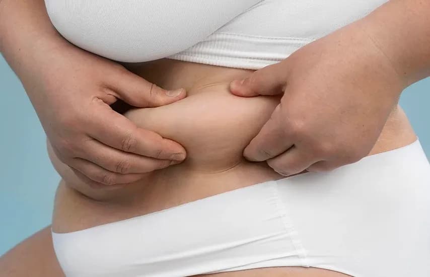 Cortisol changes fat distribution.  