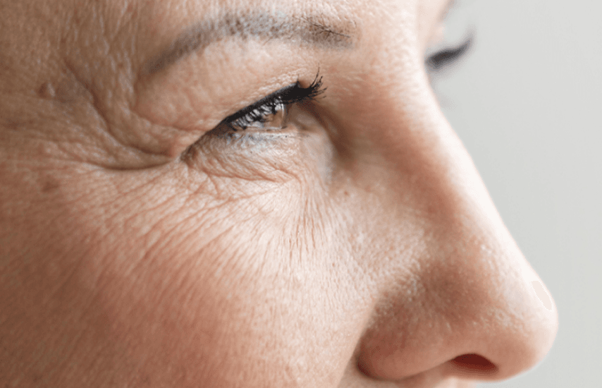 Once women enter perimenopause or menopause, everything about the skin begins to change.