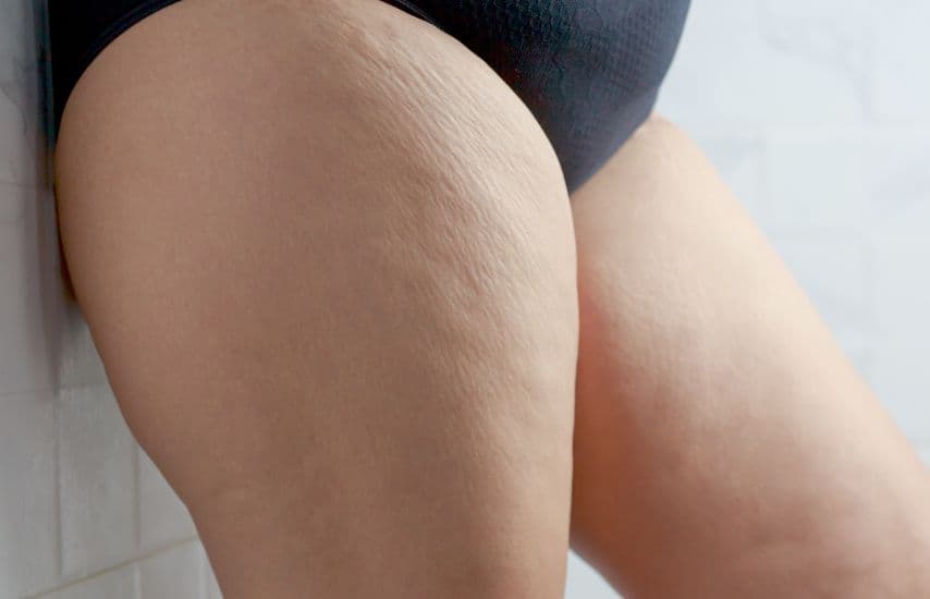 Inflammation causes poor lymphatic drainage.