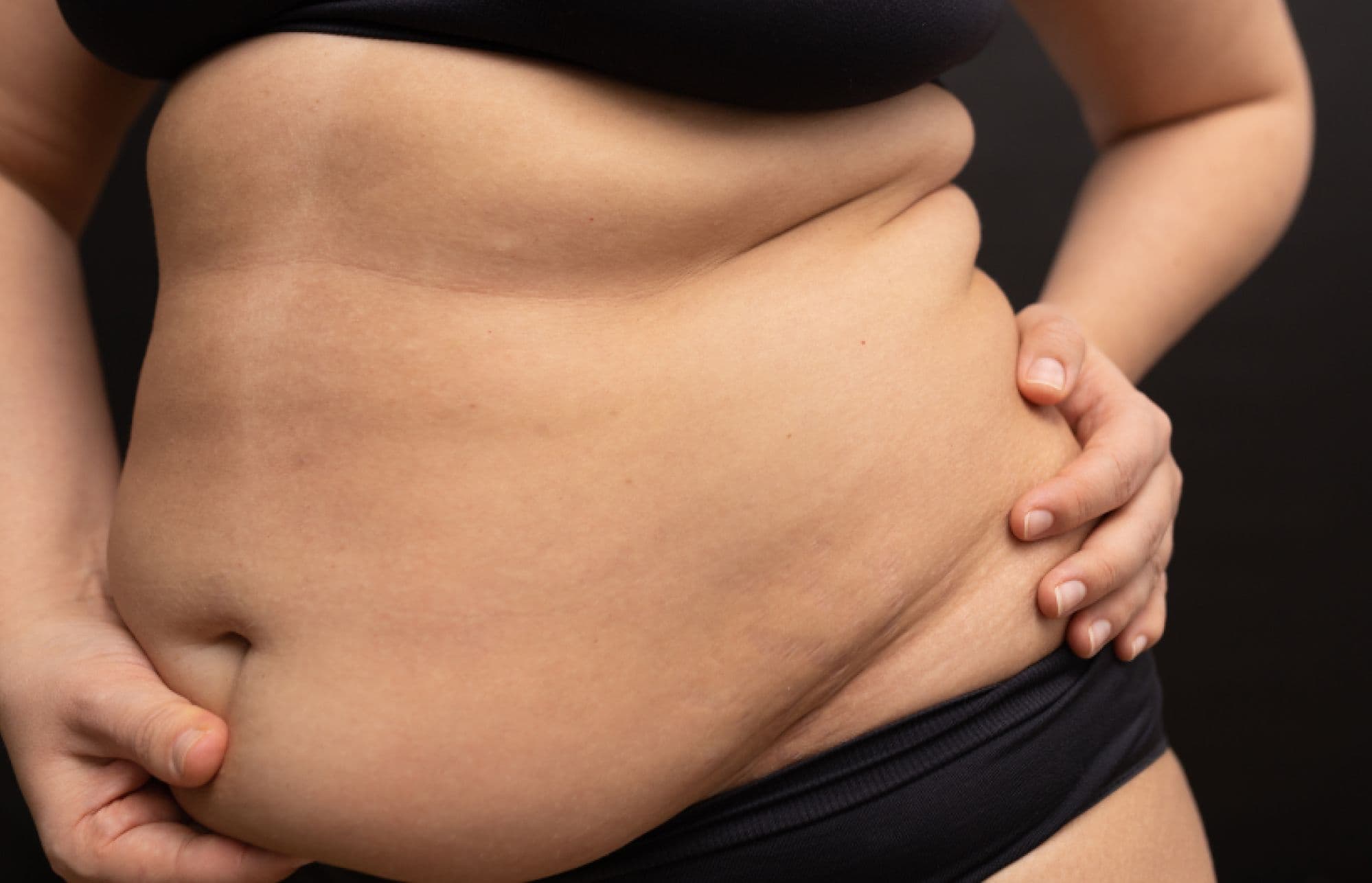 While weight loss injections suppress appetite while you’re taking them, once you stop, natural GLP-1 production often remains low.