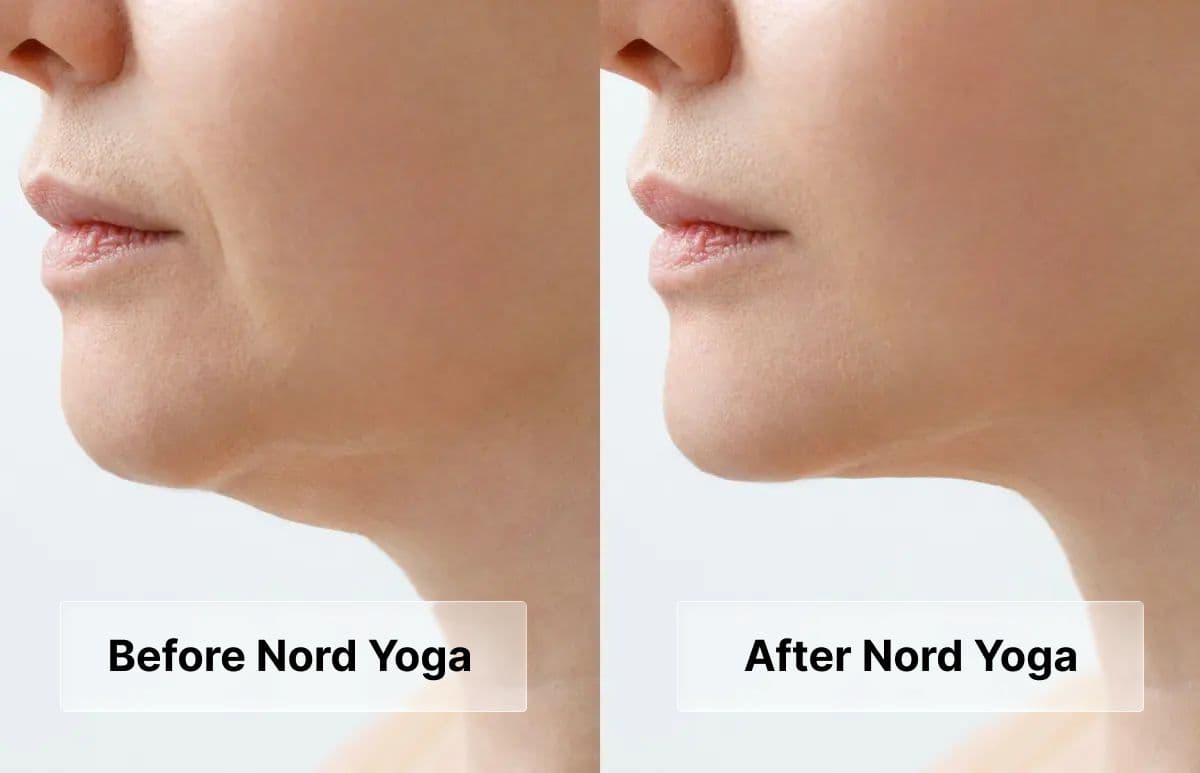 The results from Nord Yoga.