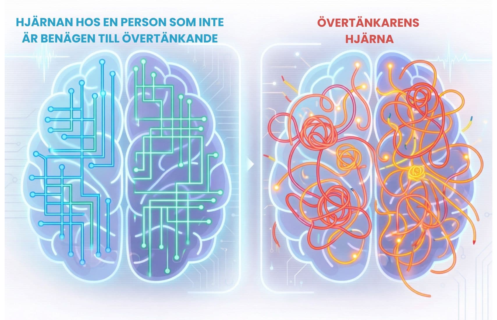 Overthinking brain comparison.