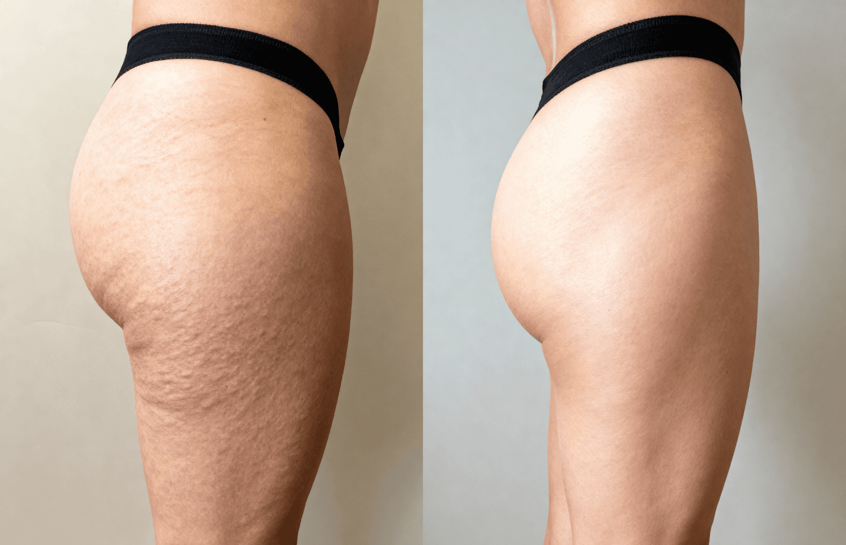 Results before and after.