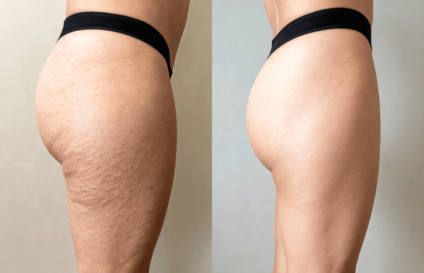 Before and after the program.