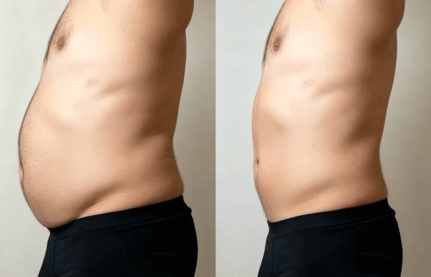 Before and after the Nordletics program.