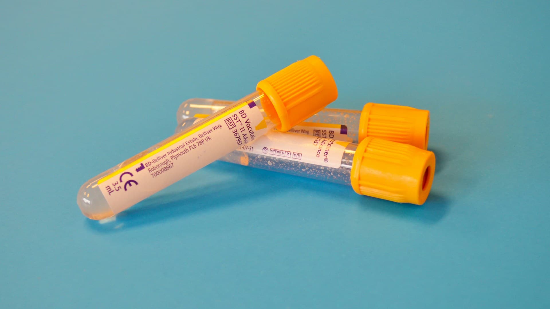 kan testi sonuçları